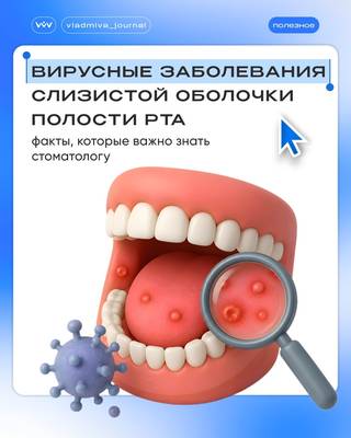 Герпес в полости рта: скрытая угроза при осмотре.